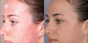 221K views · 4.8K shares | DIY FACE MASK TO REDUCE LARGE PORES | Natural Beauty Tips | Facebook