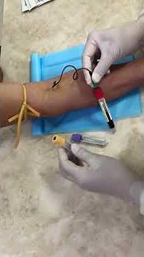 Order of Draw #phlebotomy #phlebotomist #blutentnahme #coletadesangue #採血