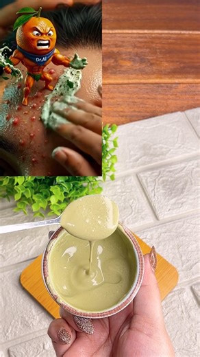 Useful Tips #facts #homeremedies #skincaretipsinhindi #healthytips #yt