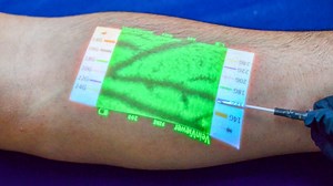 VeinViewer® Vision2 with CathCompass