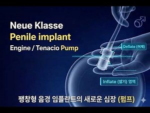 The heart of the Neue Klasse penile implant has changed (Tenacio pump)