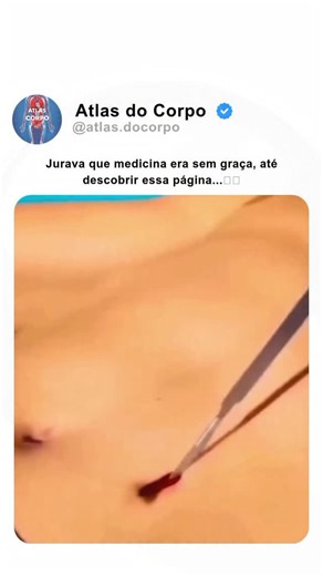 Atlas do Corpo on Instagram: "🧠 O que é a bolsa de colostomia? A bolsa de colostomia é um dispositivo usado por pessoas que passaram por uma cirurgia onde o intestino grosso (cólon) passa a eliminar fezes por uma abertura no abdômen, chamada estoma 👶➡️🩺 Ela coleta os resíduos com segurança, conforto e discrição 💪👜 🧩 Para que ela serve? ✨ Coletar fezes ✨ Proteger a pele ao redor do estoma ✨ Dar autonomia e qualidade de vida ✨ Permitir que a pessoa siga sua rotina (sim, inclusive trabalhar,