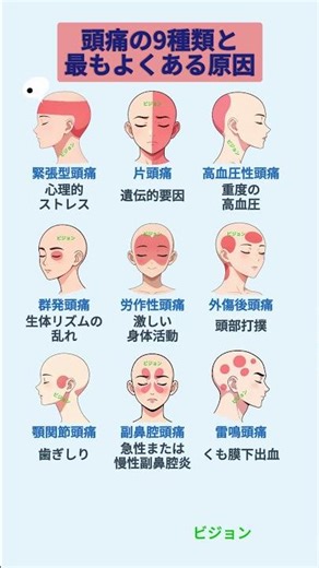 頭痛の9種類と最もよくある原因