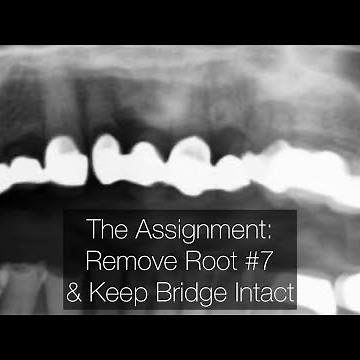 Remove Root from Under Bridge. Ready. Set. Go.