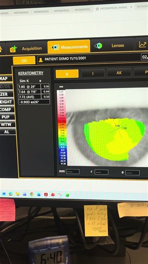 MTS2 biometer measures from thumb drive - note that this demo version did not include passwords.