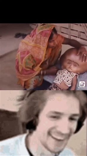NightMare Vault on Instagram: "💔 The Heartbreaking Journey of Roona Begum Born with the rare condition hydrocephalus, little Roona suffered from an enlarged head that made movement and daily life nearly impossible. After urgent surgical intervention, hope shined bright—but tragically, her life was cut short before the next critical procedure. Her story remains a powerful reminder of human bravery, medical challenges, and the fleeting nature of life. 🕊️ #roona begum #hydrocephalus #medicalmirac