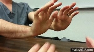 Asterixis (AKA Flapping Tremor) on Make a GIF