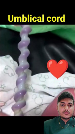 Umblical cord #umblicalcord #pregnancy | Yogesh Kumar