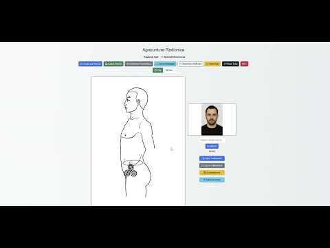 Radionic Acupuncture – New release: automatic scheduling & server-side treatments