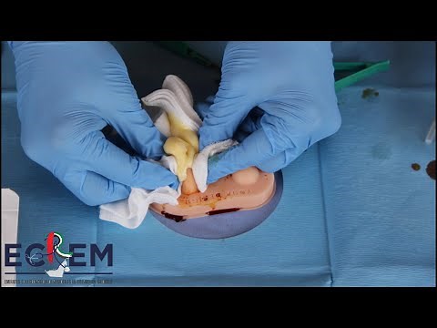 ECREM FOAMed – Incision & Drainage