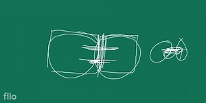 Fibroblasts, macrophages and mast cells are seen in :... | Filo