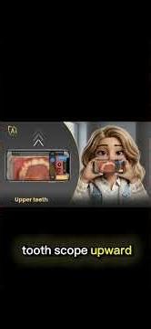 Aligner monitoring