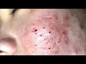 Satisfying and Relaxation with NaSa Beauty Spa Video #257