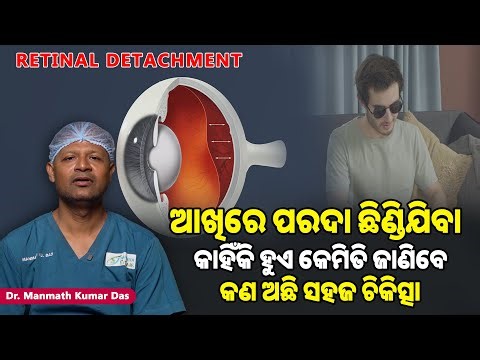 Retinal Detachment: Flashes, Floaters, Shadow in Vision? Causes & Best Treatment You Must Know!