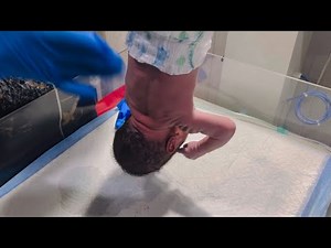 Baby Delay Cry After Birth First golden Minute Resuscitation and Recovery ❤️‍🩹