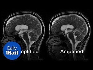 New MRI captures and magnifies the movement of the brain