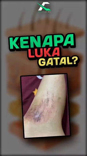 Kenapa Luka Malah Gatal Saat Mau Sembuh? #education #viral #shorts #faktaunik #facts #faktamenarik