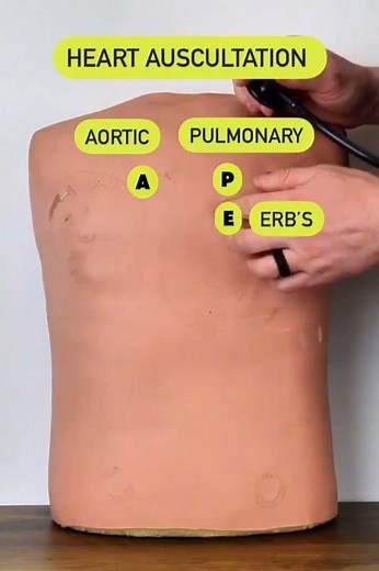 Heart Auscultation: 5 Key Areas (Valves) | DM AYU ACADEMY🏆