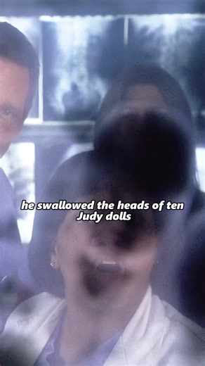 Why swallow the head of a toy doll? The inexplicable strange case