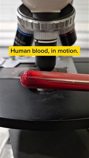 Red blood cells under the microscope?