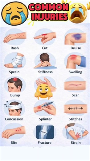 Injury? Act fast ⏱️ Right first aid can save you ⚠️#injury #firstaid