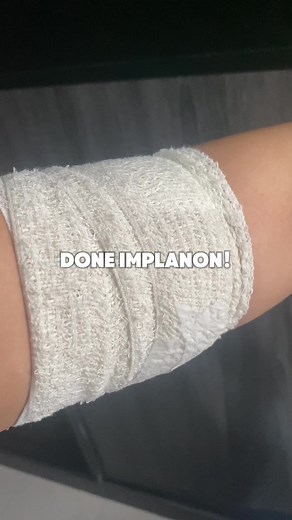 Renew another 3 years. Mommies ambik perancang apa? #implanon #perancangkeluarga @KLINIK ANDA SUNGAI PETANI 24J