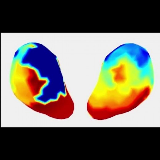New Imaging Tech Produces Real-Time 3D Maps of Uterine Contractions During Labor