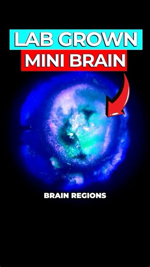 Dr Ben Miles | Scientists Create First Complete Lab-Grown Mini Brain. A multi-region brain organoid, which could be a pivotal tool in studying... | Instagram