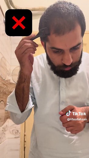 How to use derma roll properly #HowToUseDermaRoller #DermaRollerSkincareRoutine #BenefitsOfDermaRolling #MicroneedlingAtHome #DermaRollerForAcneScars #DermaRollerForHairGrowth #BestDermaRollerTechniques #DermaRollerBeforeAndAfter #SkincareAfterDermaRolling #DermaRollerFrequency #DIYMicroneedlingTips #DermaRollerSideEffects #DermaRollerNeedleSize #HowOftenToUseDermaRoller #DermaRollerForAntiAging #CanIUseDermaRollerEveryday #DermaRollerResults