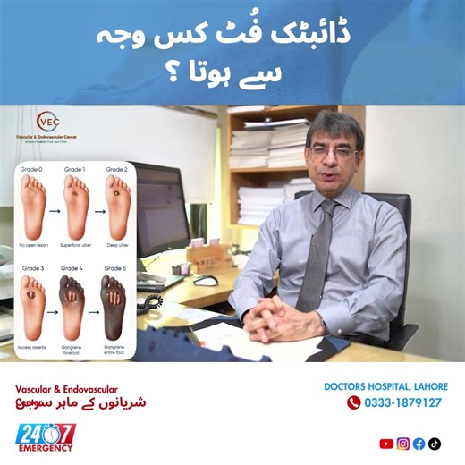 What Causes Diabetic Foot? | Dr. Ilyas Sadiq Vascular Surgeon | Vascular Surgery Awareness Pakistan