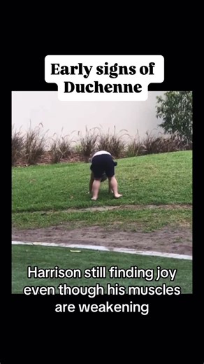 Harrison’s Life with Duchenne Muscular Dystrophy on Instagram: "👣 Early Signs of Duchenne Muscular Dystrophy (DMD) Duchenne can show up in small ways long before a diagnosis, often in the way a child moves, runs, or even gets up from the floor. Many parents sense something’s different before they have words for it. If you notice any of these signs, it may not mean Duchenne but can mean further testing is worth exploring by having discussions with medical professionals. ⚠️ Movement clues • Not w