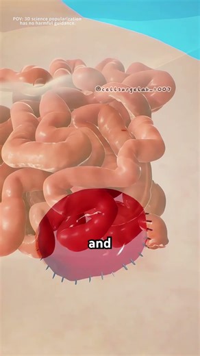 How a colostomy bag works?(3D Animation) #medical3danimation #science #gastroenterology #ostomate