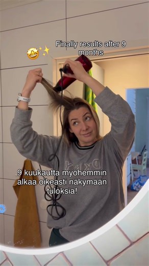 Hiusten kasvu alkaa vihdoin näkyä! Seerumin käyttö ja vähempi stressi ovat varmasti osasyynä kasvuun