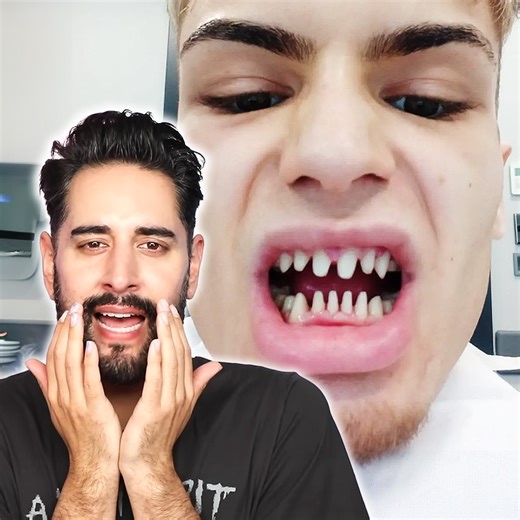 446K views · 3.2K reactions | The Real-Life HORROR Stories Behind the 'Turkey Teeth' #CosmeticDentistry #Cheap #Dangerous | James Welsh | Facebook