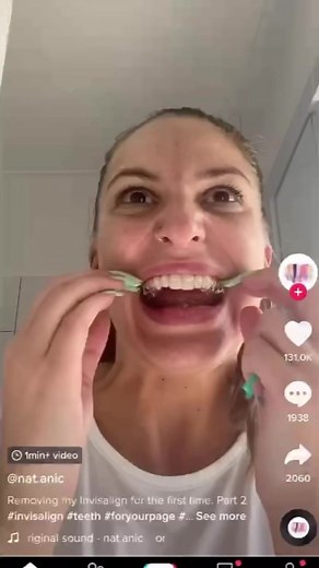 How to Properly Remove Invisalign Aligners | Invisalign Tips