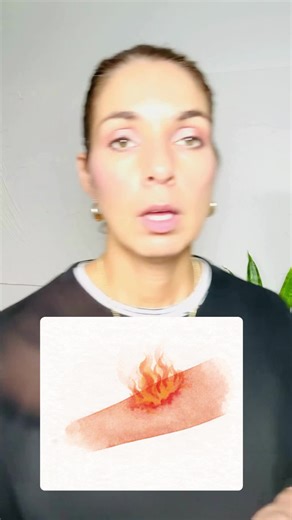 Day 25 🩺 Medical Spanish Mini-Lessons — Injuries Let’s talk about common injuries in Spanish. 🤒🤢🤕 #spanishlessons #learnspanish #spanishteacher #medicalspanish #spanishfornurses #spanishfordoctors #bilingualnurse #learnspanishfast