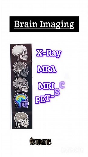 🧠 "5 Powerful Brain Scans Explained in Seconds!", ‪@studytips-p9n‬