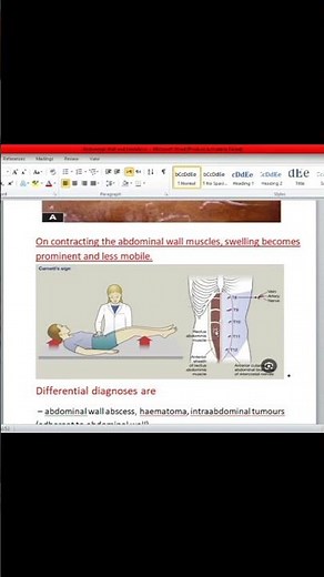 carnett sign #dr #shorts