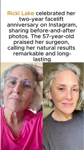 Ricki Lake Celebrates Her Two-Year Facelift Anniversary with New Before-and-After Photos