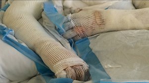 The Pete Dern Story: Pete's hands