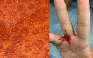 Lady claims to have gotten bloodied up by sharp metal objects embedded into bus seats | Coconuts