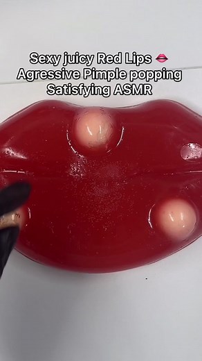 Lips intensive pimples treatmemt #foryou #fypシ゚viral🖤tiktok #CapCut #asmr #oddlysatisfying #mochipimplepopping #pimplepop #viral #reliable #fidgettoys #satisfying #lips #redlips #sexylips #beautifullips #biglips #grandelips #lipspimples #emojilips