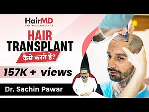Hair Transplant कैसे करते हैं? | Understanding the Hair Transplant Procedure | HairMD, Pune