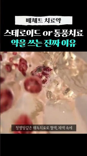 베체트병 증상엔 어떤 치료 약을 써야 잘 들을까? 완치로 가는 길 알려드려요