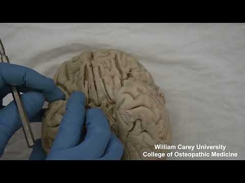 Insula and primary auditory area #neuroanatomy #cortex #cerebral hemisphere #medicalstudent#brain