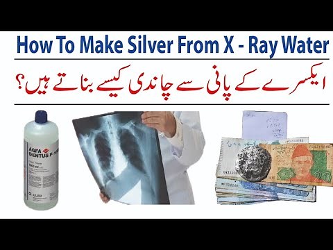 x ray silver recovery method | x ray film silver recovery