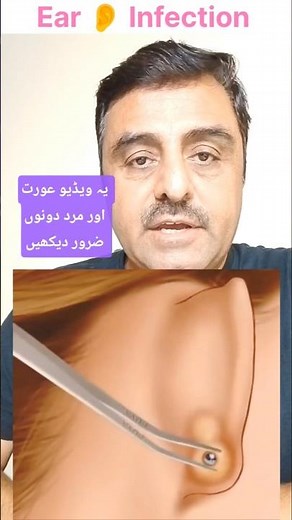 How Ear Infection will happen Check the Medical Tips