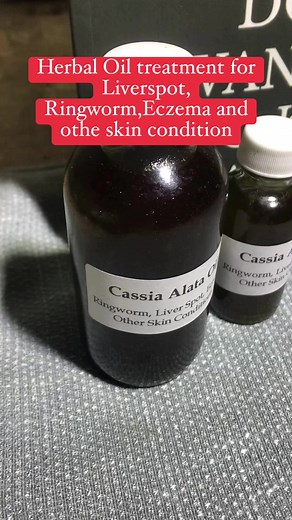 5.3K views · 57 reactions | Liverspot remover | Herbs and Wellness | Facebook