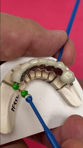 Adding Attachments for a Partial