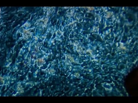 Stem Cells 101 - Mayo Clinic